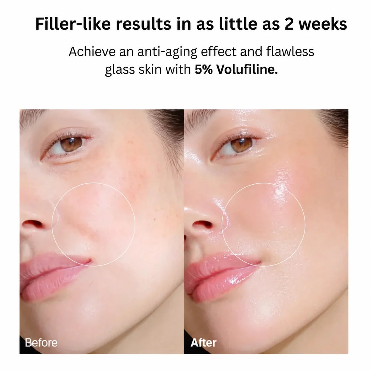 VoluFine - Korean Collagen Serum with Volufiline