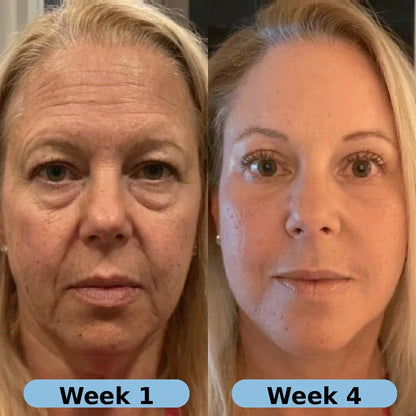 VoluFine - Korean Collagen Serum with Volufiline